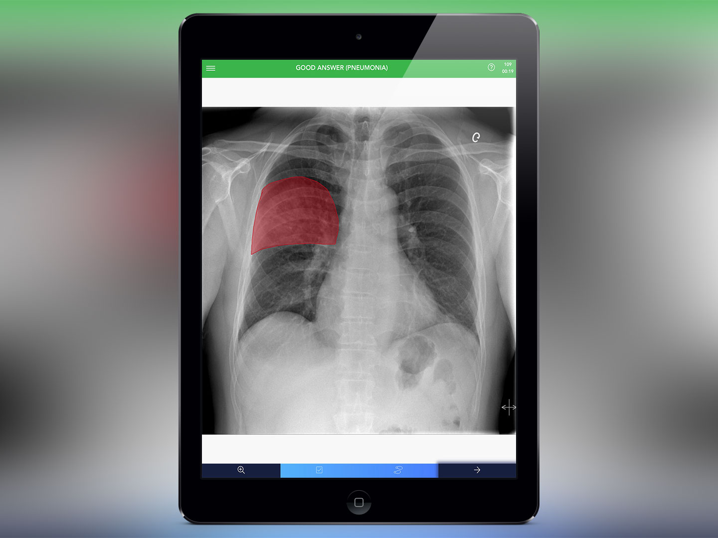 Chest X-Ray Experience