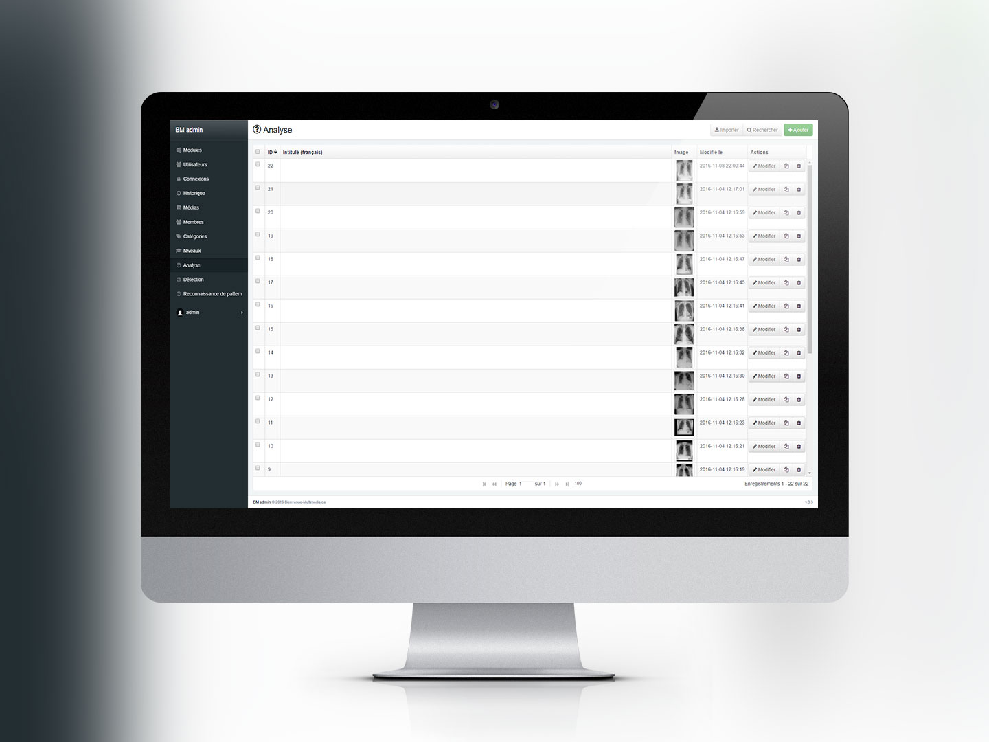 Chest X-Ray Experience