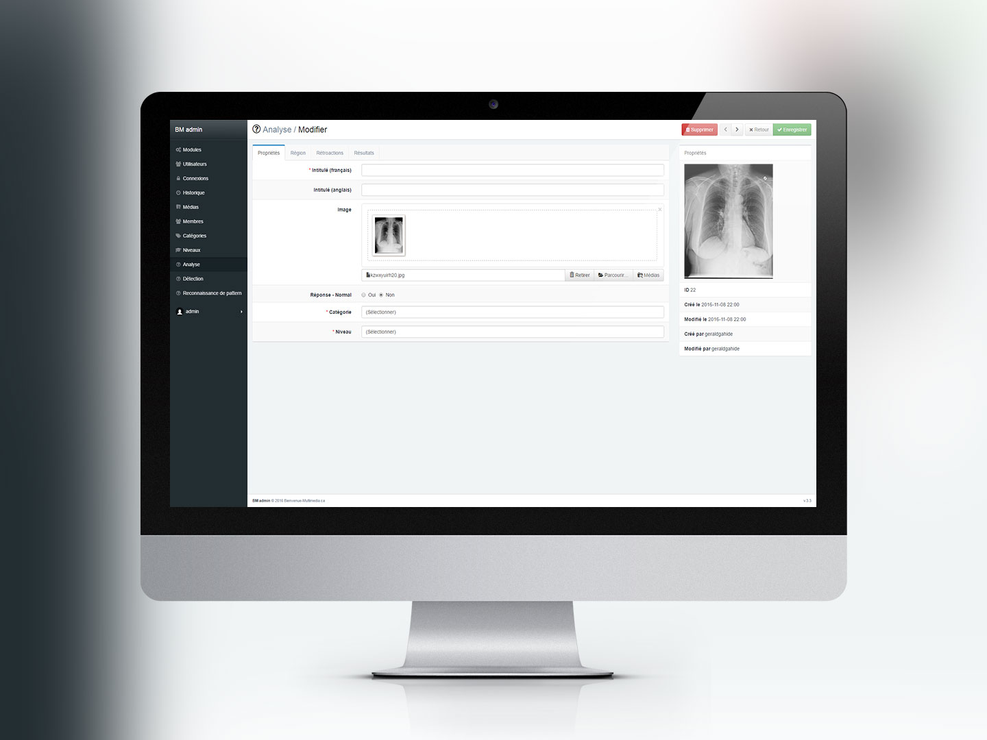 Chest X-Ray Experience